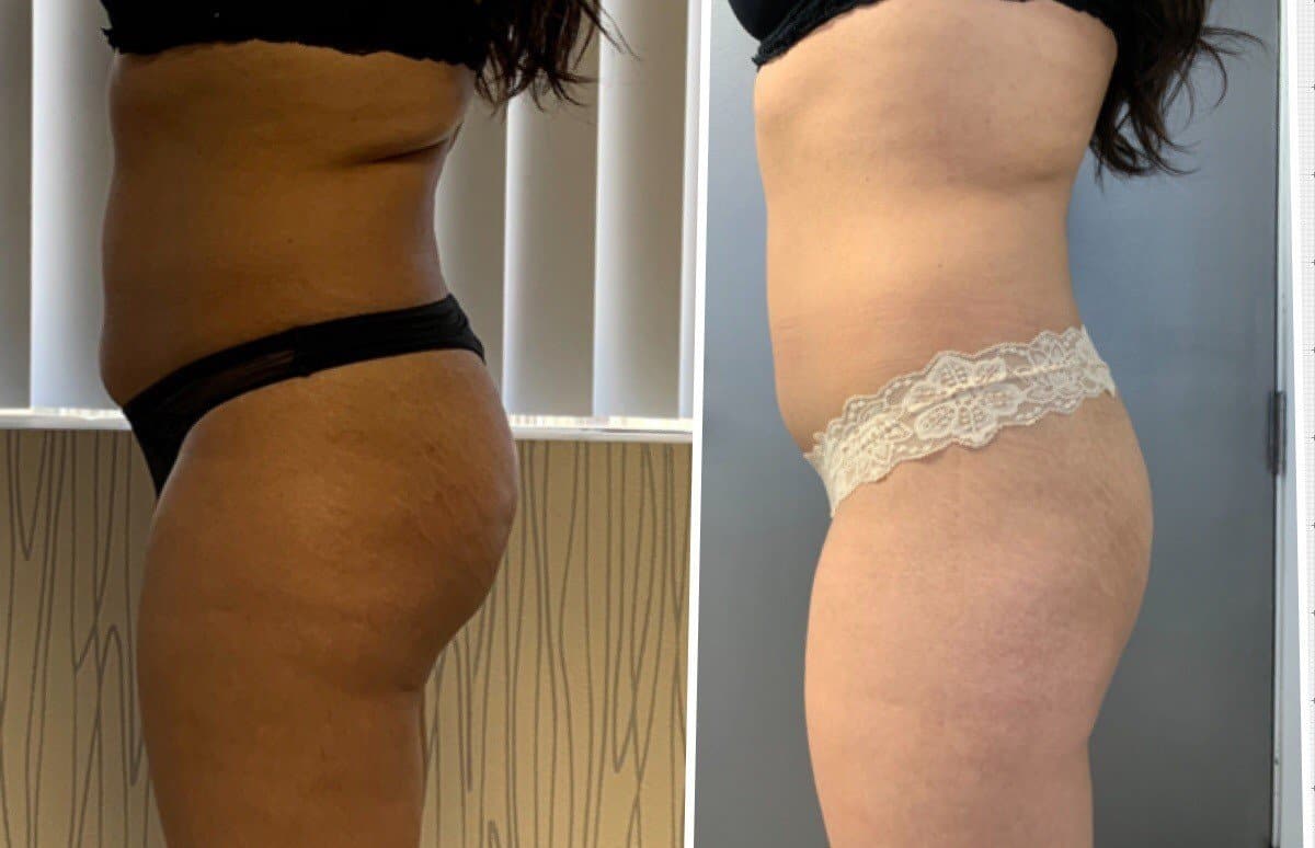 THE BEST 10 Body Contouring near BOLSA AVE, WESTMINSTER, CA 92683 - Last  Updated March 2024 - Yelp